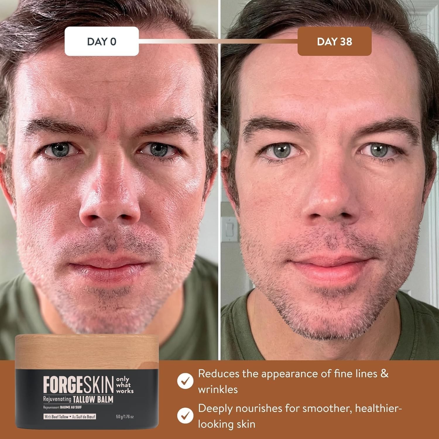 FORGE SKIN® Beef Tallow Balm for Men, Anti-Aging Face Moisturizer, 1.7 Oz