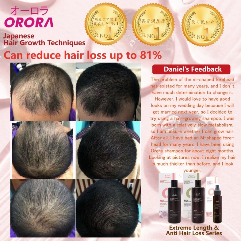 Orora Extreme Length & Anti Hair Loss Shampoo 300ML