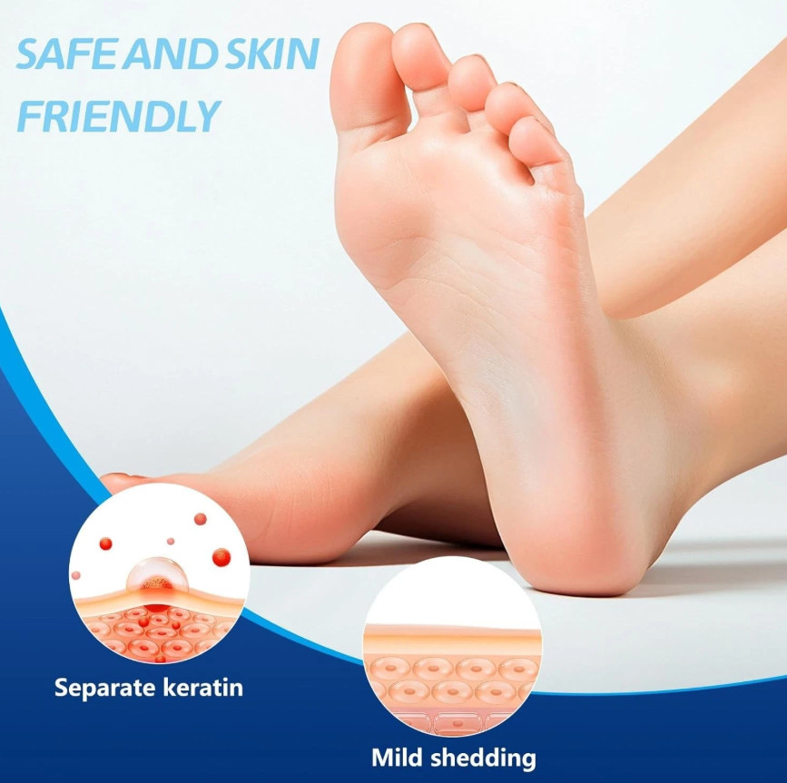 Wart Relief Cream for Genital, Plantar, Common, Flat & Filiform Warts