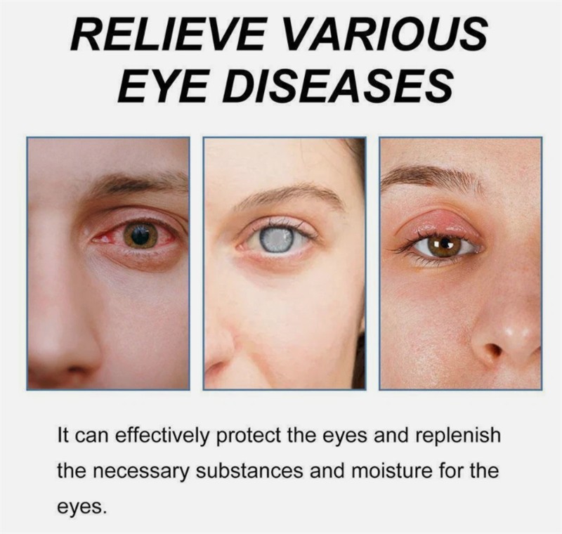 Cataract Removal Eye Drop Improve Blurred Vision Restore Eyesight Hot US