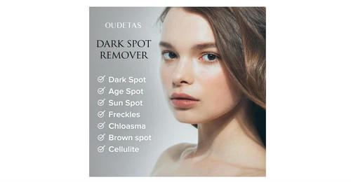 Share Dark Spot Remover for Face and Body Musely Dark Spot Remover for Melasma S