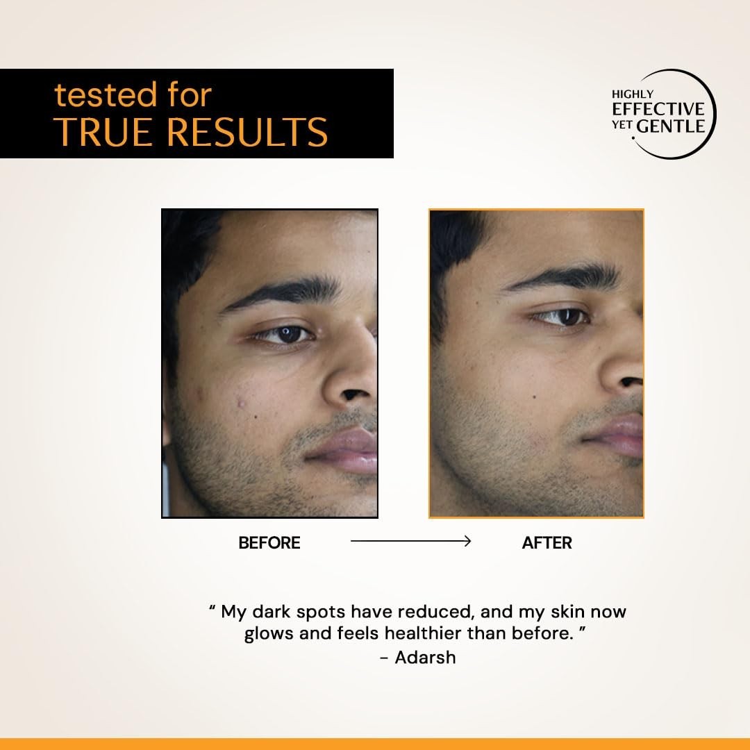 Deconstruct 10% Vitamin C Serum for Oily Skin| 10ml