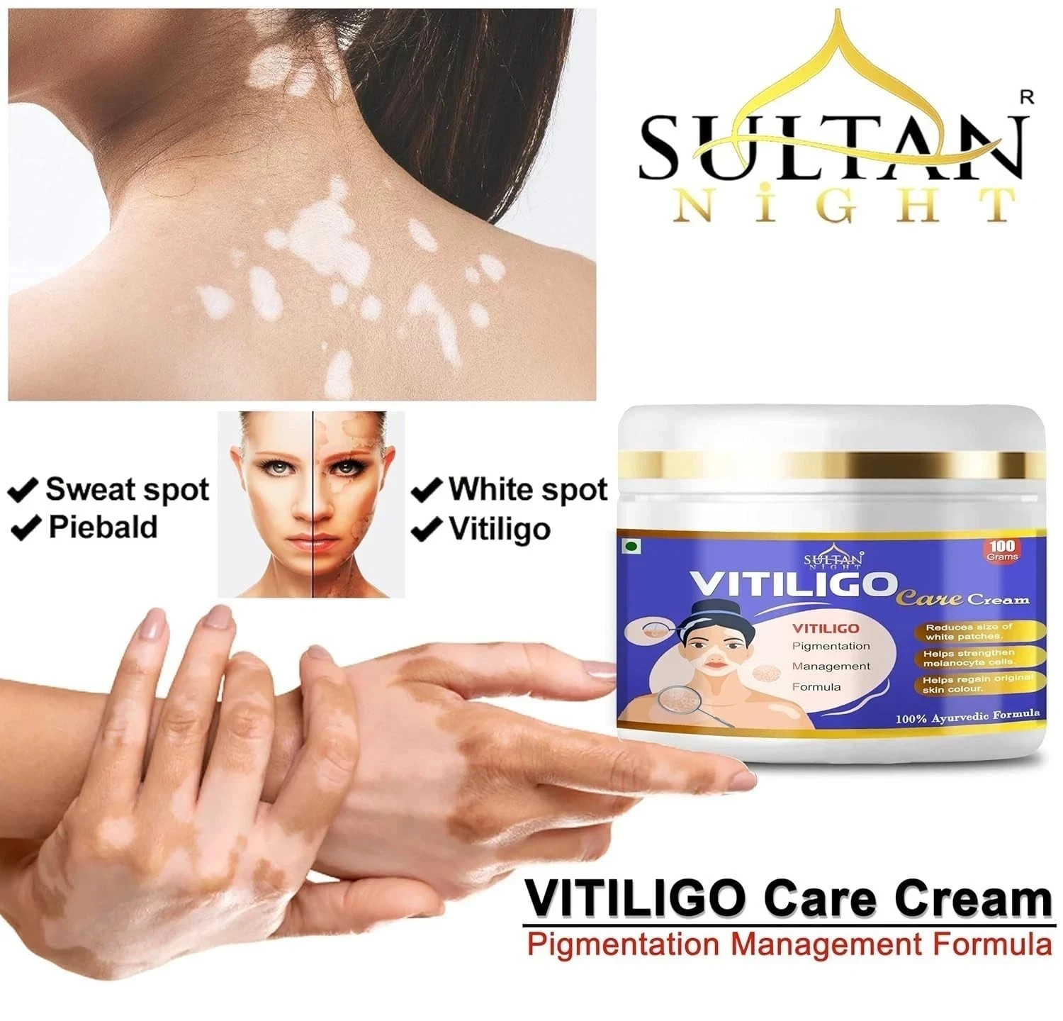 Vitiligo Cream 100gm Effective Herbal Formula For White Patches & Skin Repair