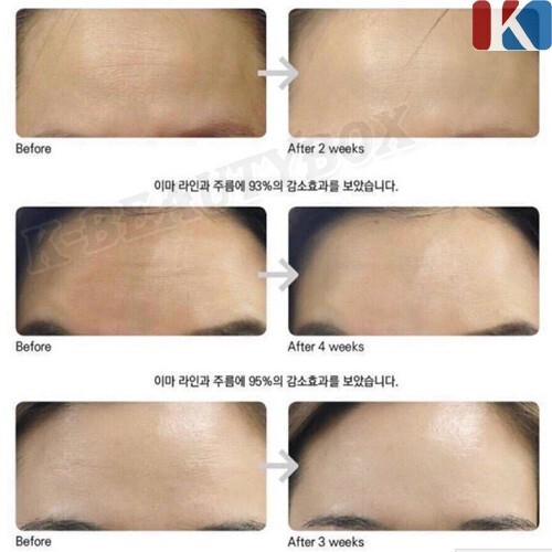 ESTHEMAX Collagen Ampoule 10EA Power Lifting Firming Ampoule Anti-Aging Ampoule