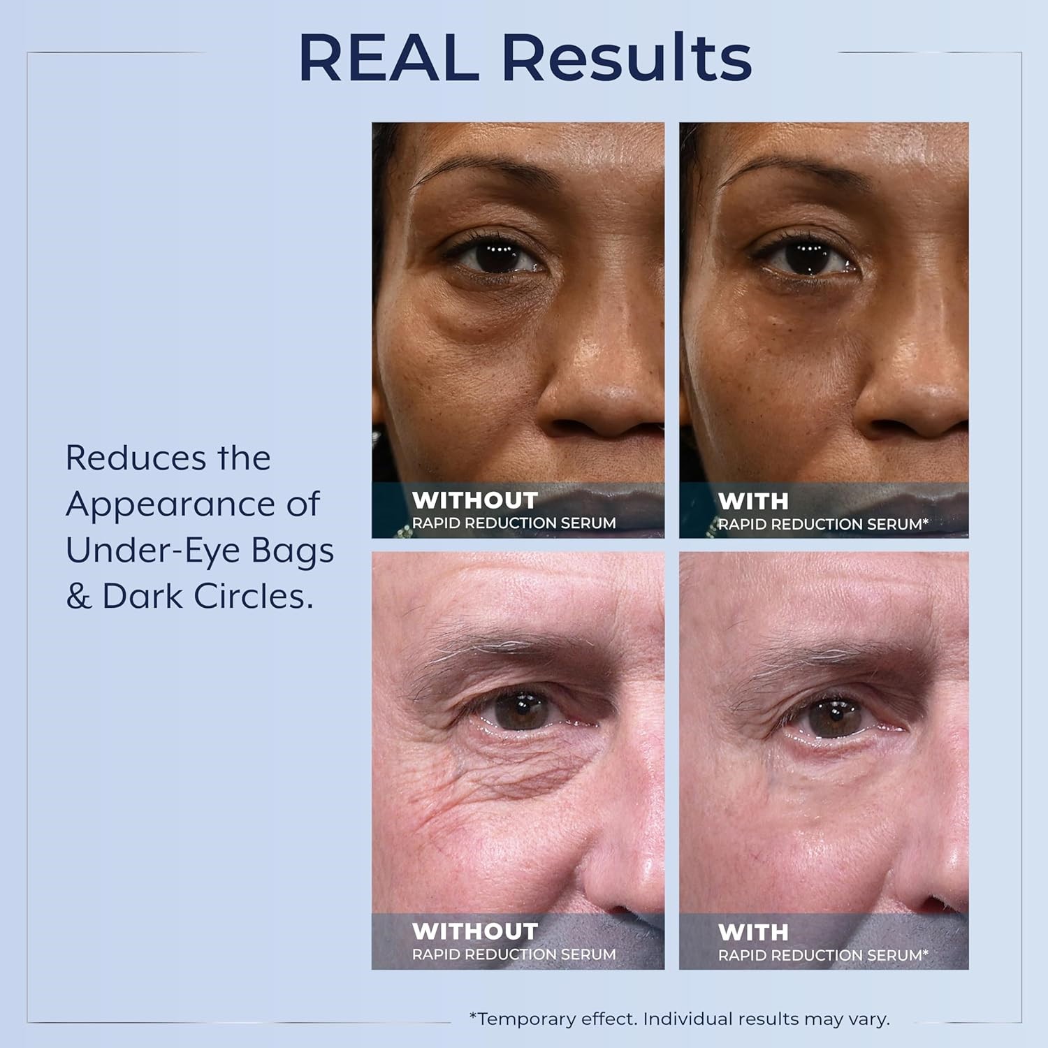 Plexaderm Rapid Reduction Eye Serum – Visibly Reduces Under-Eye Bags, Wrinkles~