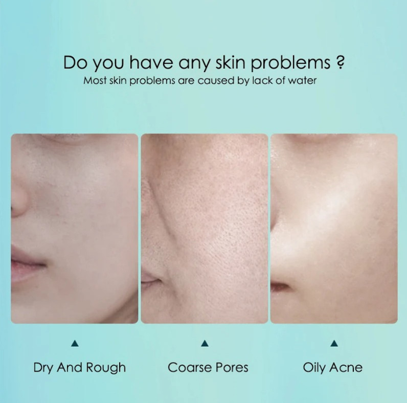 10pcs Hyaluronic Acid Hydrating Facial Sheet Mask Skin Care Set Face Masks – NEW