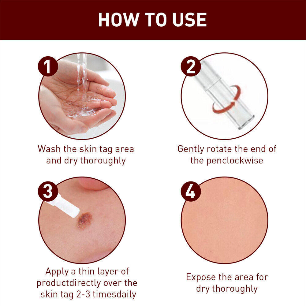 «FINAL SAL» Skin Tags & Moles Removal Quick Safe Remover Restore Skin 3ml US