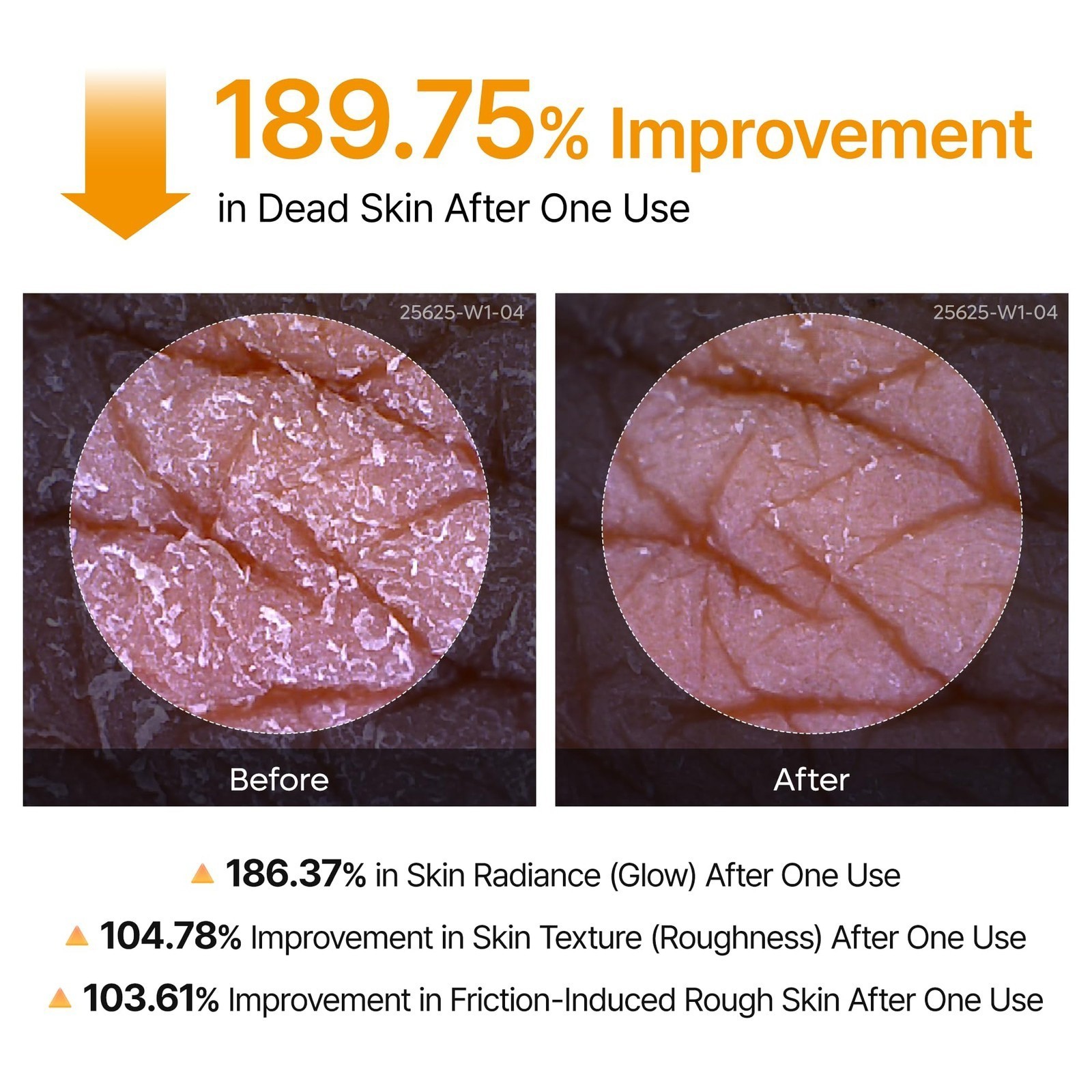Body Keratin Care Kojic Acid Turmeric Spray Gently Exfoliating Peeling Soluti…