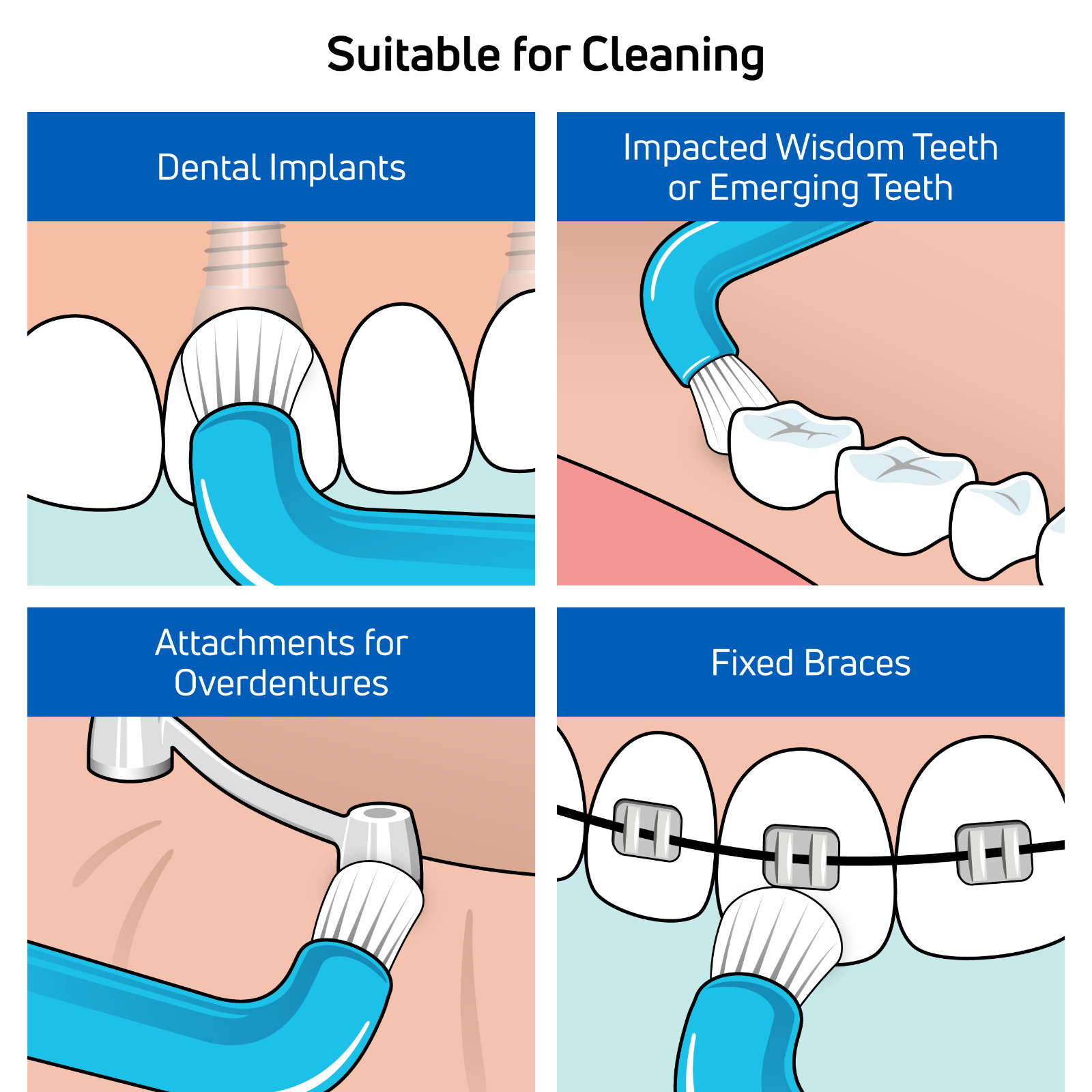 TEPE Compact Tuft Toothbrush – Braces & Hard to Reach Areas, 1 Pk