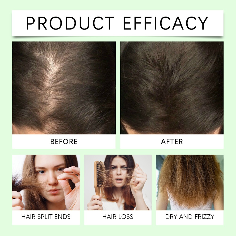 2 Pack Organic Rosemary Hair Growth Shampoo for Women and Men-Natural Thickening