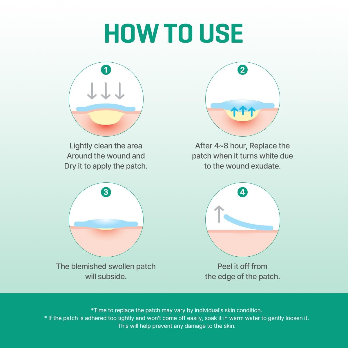 SOME BY MI 30 Days Miracle Clear Spot Patch – Pack of 5, 18 Count (Pack 5)