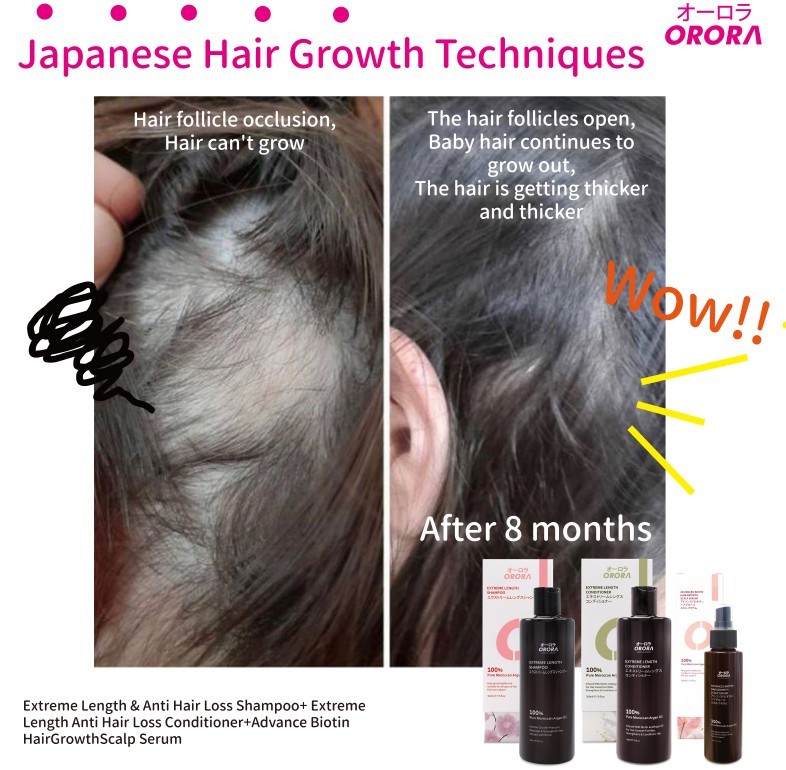 Orora Extreme Length & Anti Hair Loss Shampoo 300ML