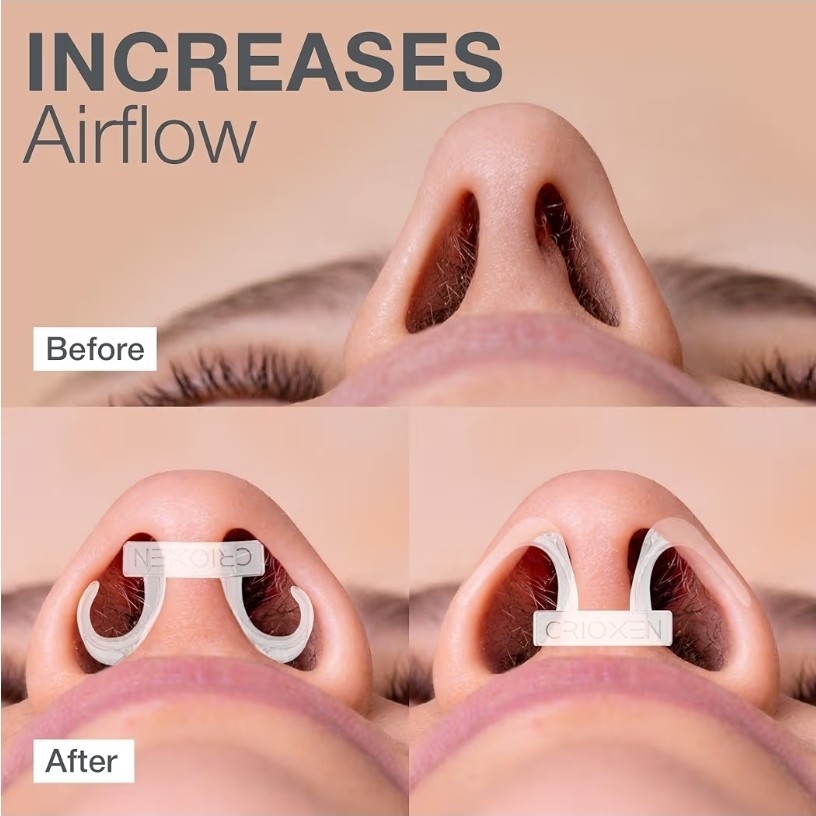 Nasal Dilators for Breathing Sleeping – Reusable Internal Nostril Nose Opener