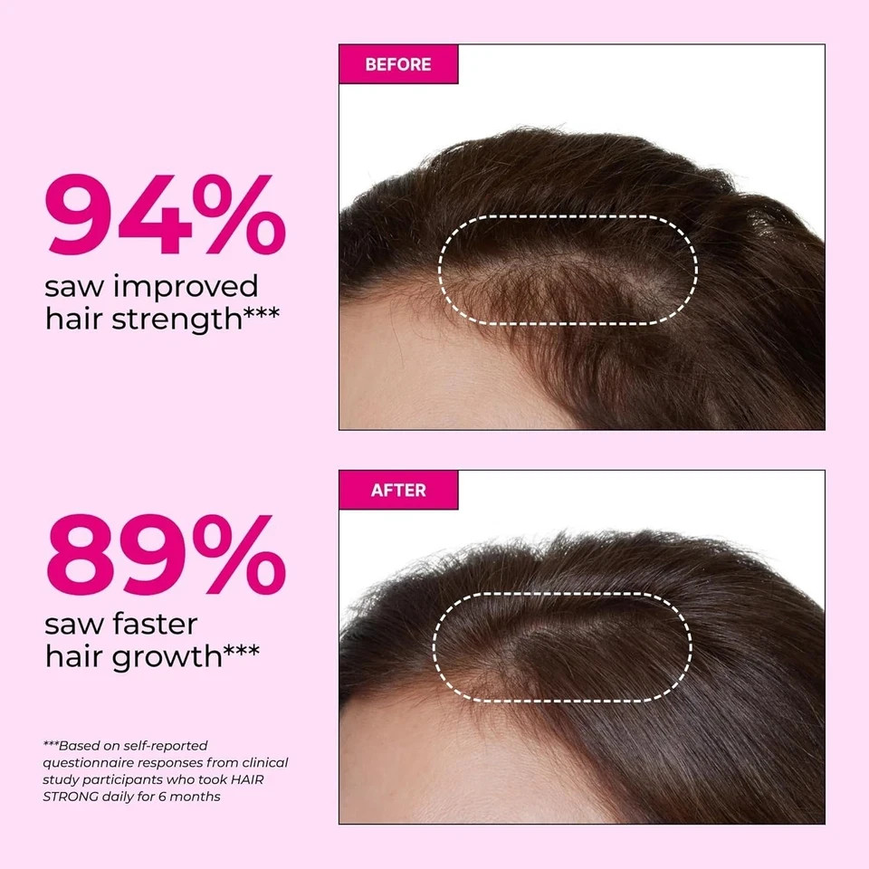 HUM Hair Strong Daily Hair Growth Supplement with Biotin, Zinc, Vitamin B12