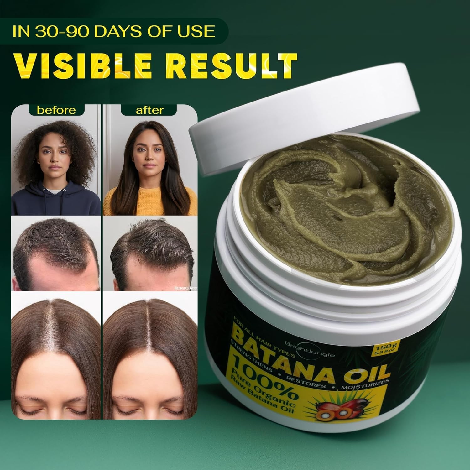 Botana Oil Hair Growth Batana Oil for Hair Growth Dr Sebi Organic,100 Percent Pu
