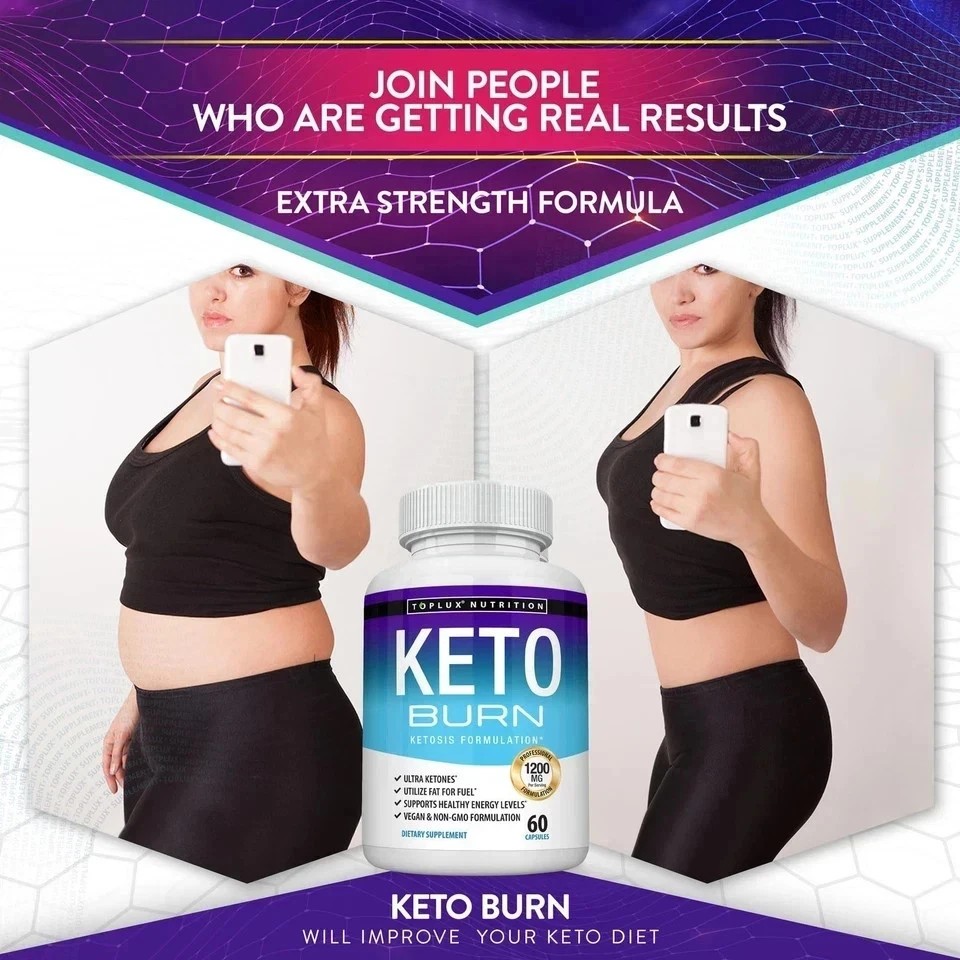 Toplux Keto Burn Pills Ketosis Weight Loss – 1200 Mg Ultra Advanced Natural