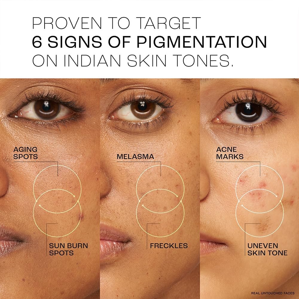Lakme Perfect Radiance Pigmentation Treatment Serum with 15% Niacinamide 15ml