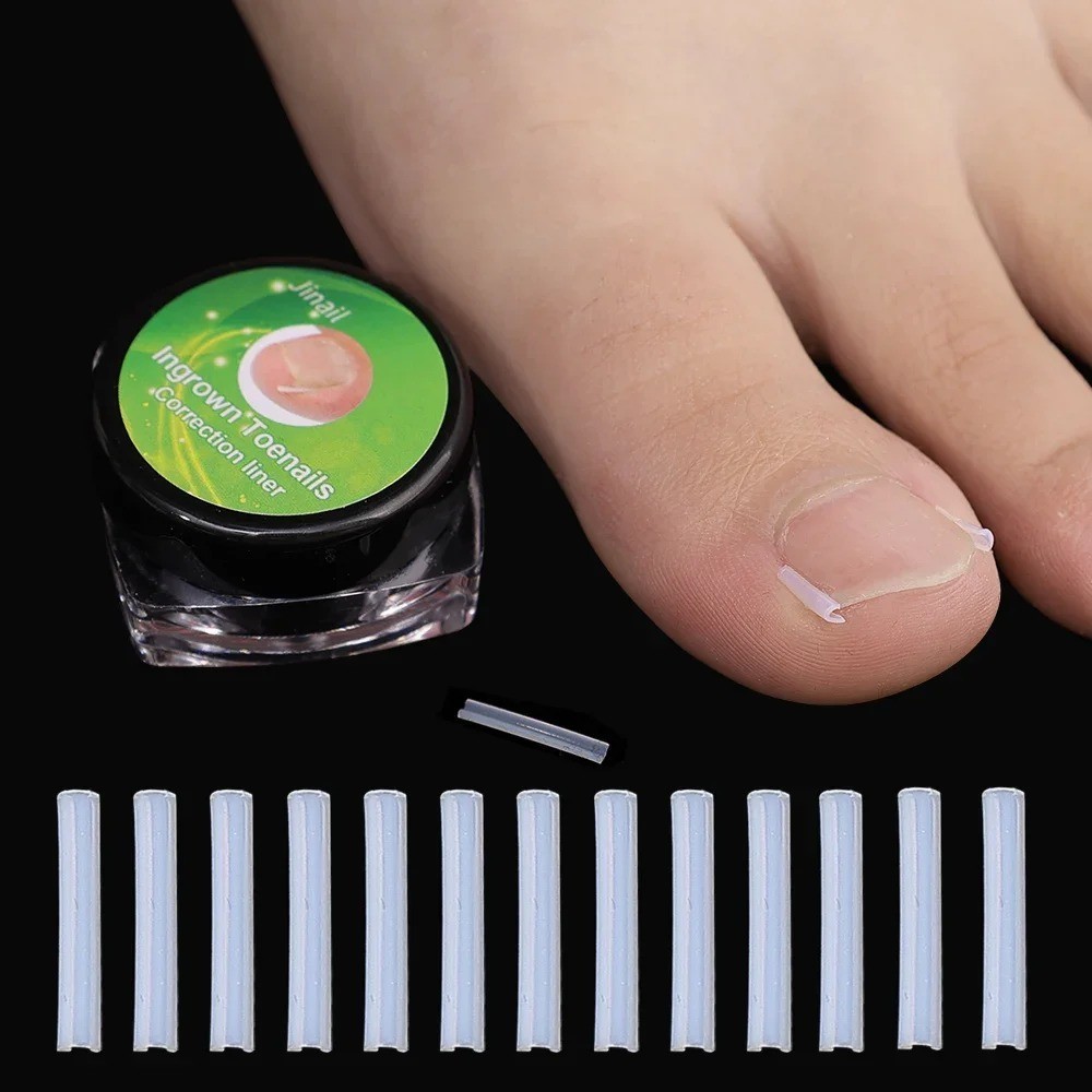 Ingrown Toenail Correction Patch Ultra Thin Elastic Nail Treatment Sticker Tool