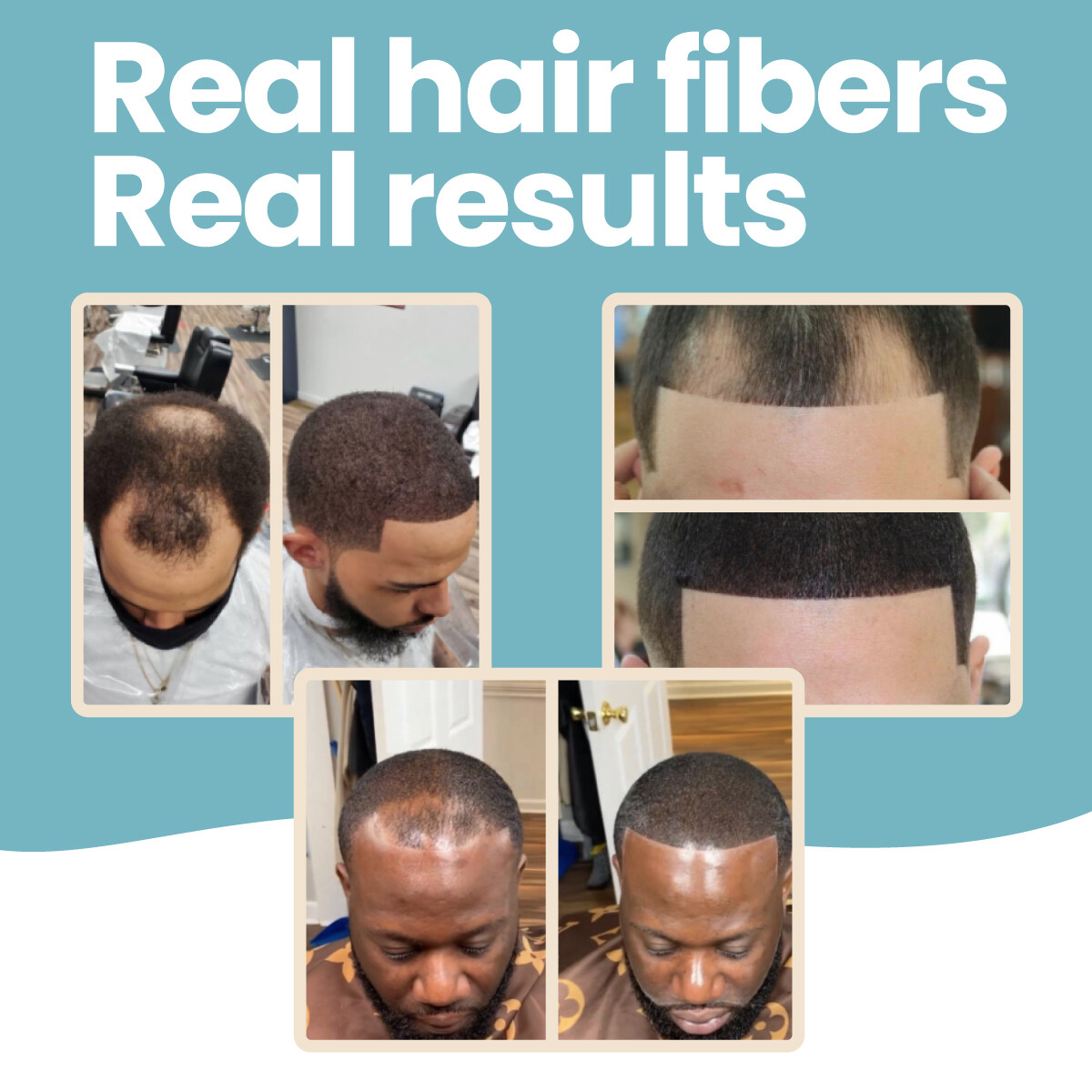 Hair Fibers by HAIR ILLUSION – Baldness & Thinning Hair Treatment for Men, Women