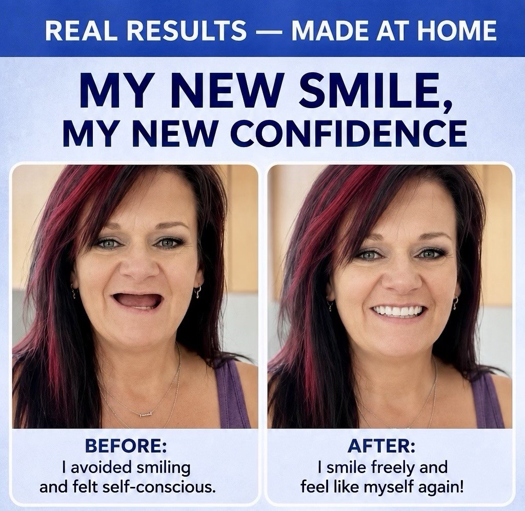 Partial Denture Kit Make Your Own Custom Denture Affordable Temporary Teeth A2