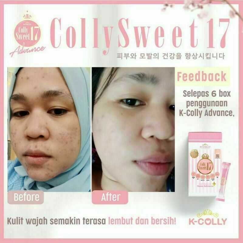 K-COLLY SWEET17 60’s Korean Nano Collagen Advance Triple Whitening Free SHIPPING