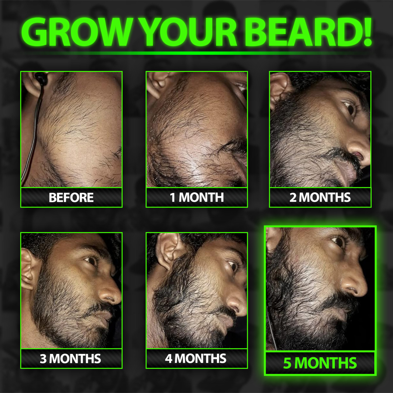GROW MAX XXL Beard & Mustache Accelerator – #1 FACIAL HAIR GROWTH OIL WORLDWIDE!