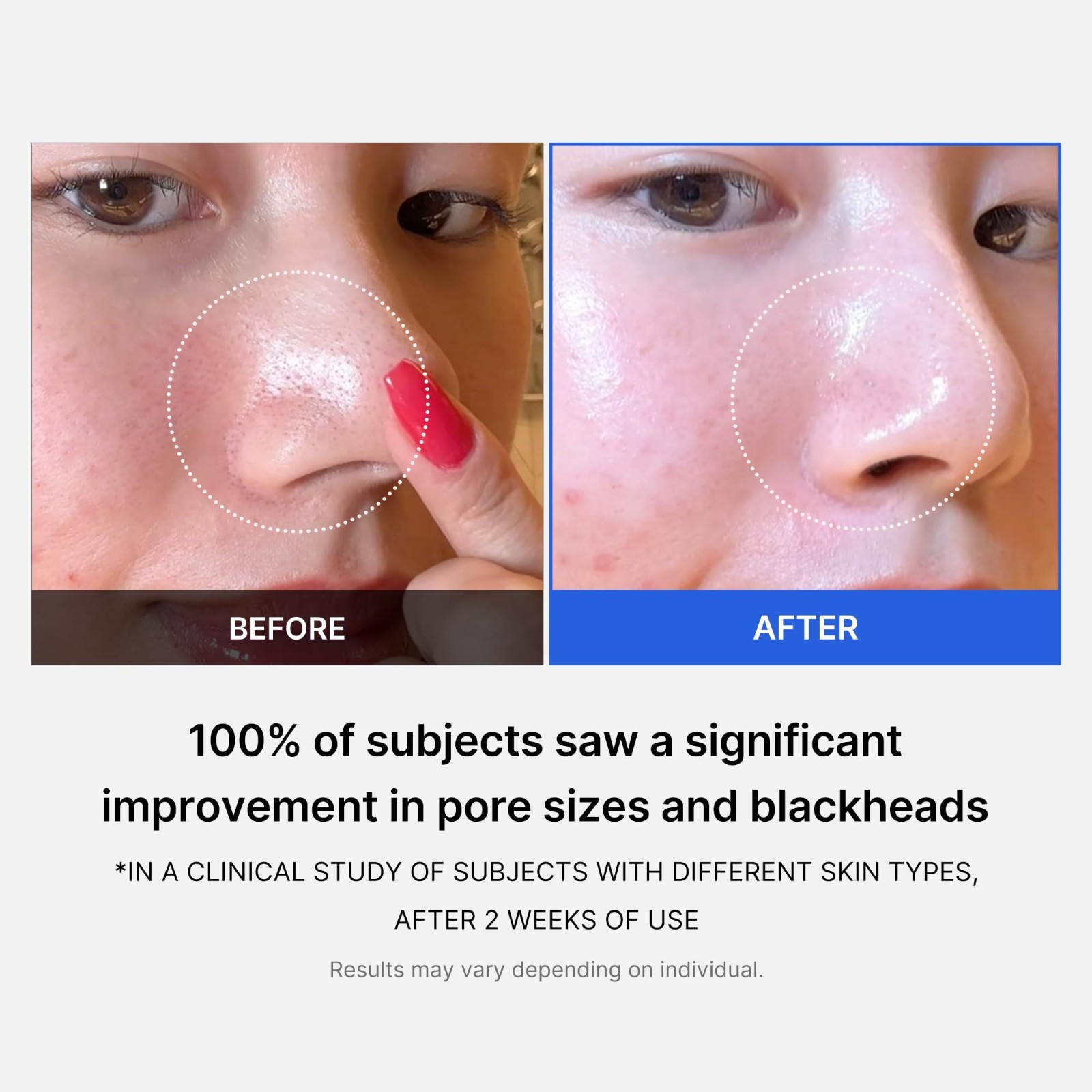 medicube Toner Pads Zero Pore Pad 2.0 | Dual-Textured Facial Pad for Exfoliation