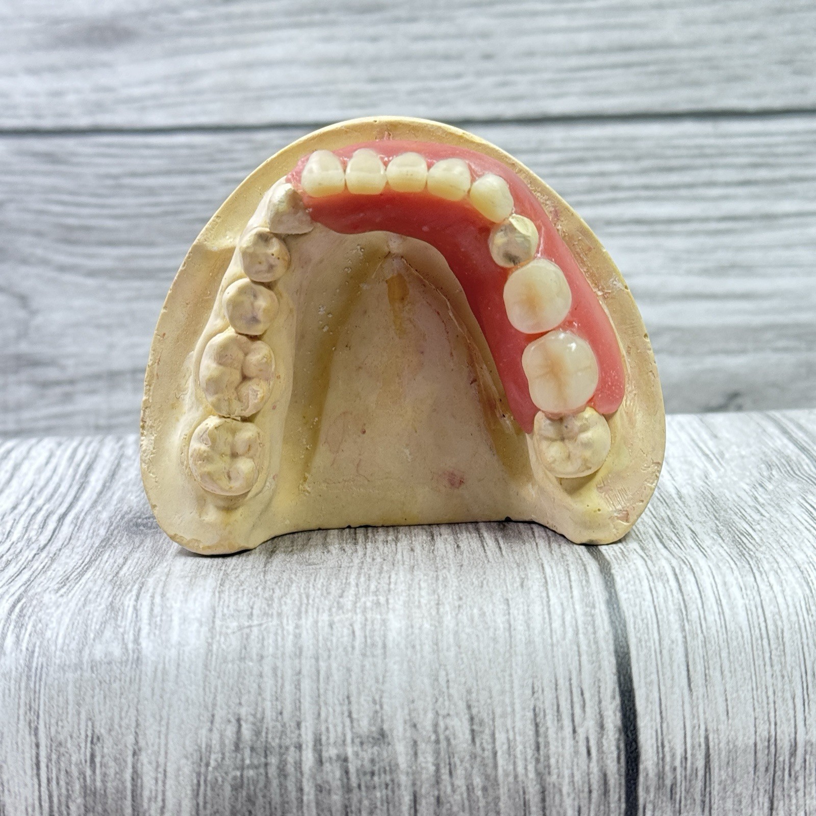 Partial Denture Kit Make Your Own Custom Denture Affordable Temporary Teeth A2
