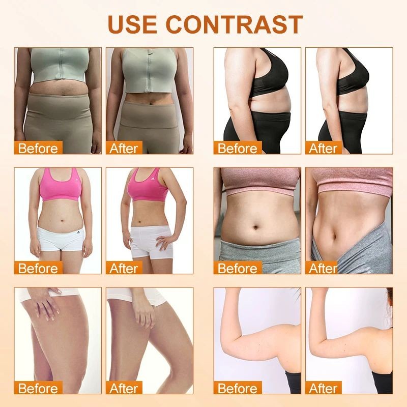 448k CET RET Diathermy Deep Body Sculpting Facial Lifting Tecar Therapy Machine