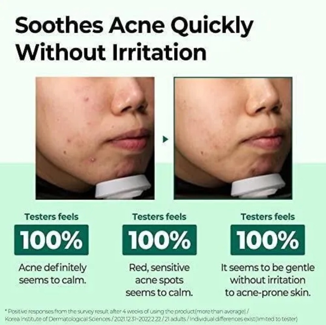 🔥[2 BOTTLES]🔥 SOME BY MI AHA BHA PHA 30 Days Miracle Cream 60g – Exp 06/2026
