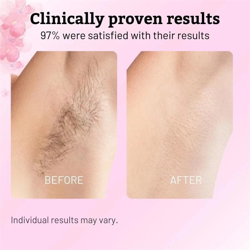 5PCS Cyperus Rotundus Oil – 60ml Natural Cyperus Rotundus Oil For Hair Removal