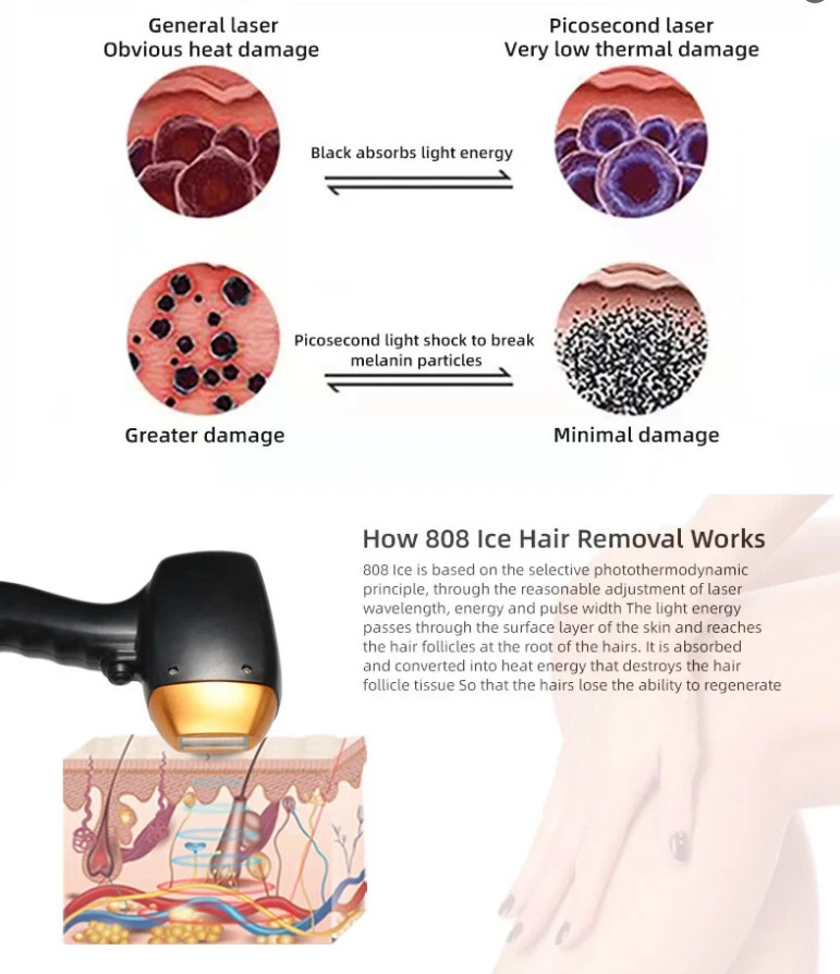 Professional Laser Tattoo Removal 2in1 Titanium Diode Laser Hair Removal Machine