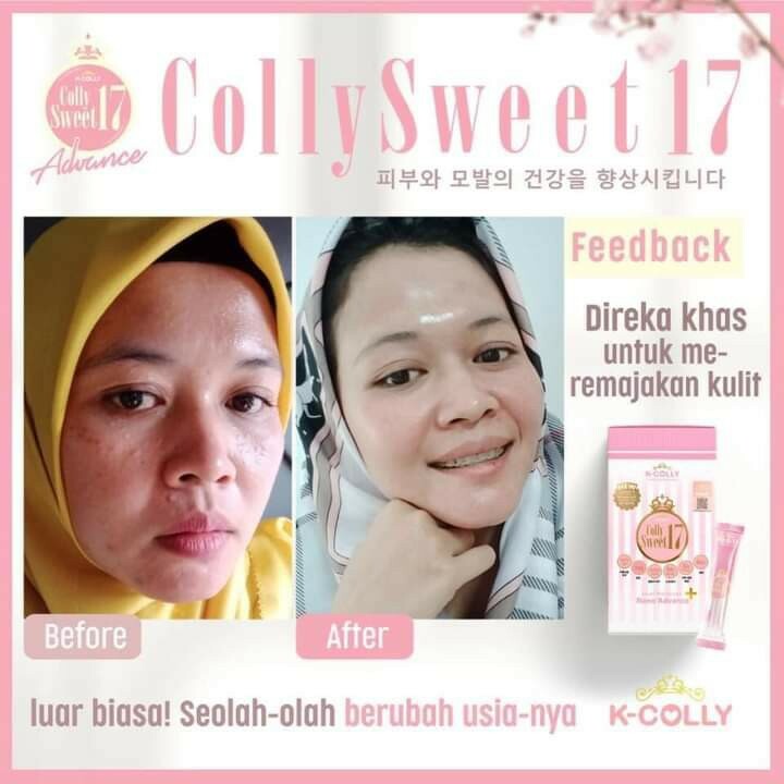 K-COLLY SWEET17 Korean Nano Collagen Advance Triple Whitening 20s EXPEDITED SHIP