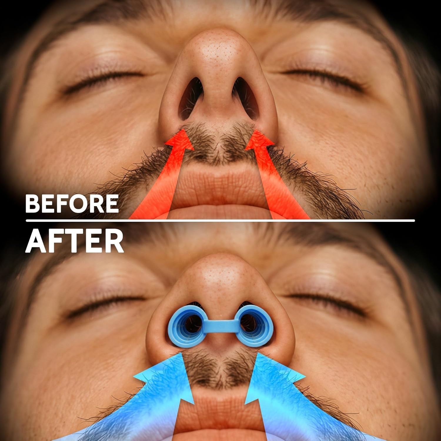 Nasal Dilators for Better Breathing & Sleep – Reusable Nose Openers, Anti-Snorin