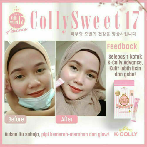 K-COLLY SWEET17 60’s Korean Nano Collagen Advance Triple Whitening Free SHIPPING