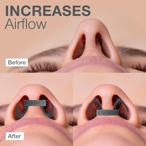 Nasal Dilators for Better Breathing & Sleep – Reusable Nose Openers, Anti-Snorin