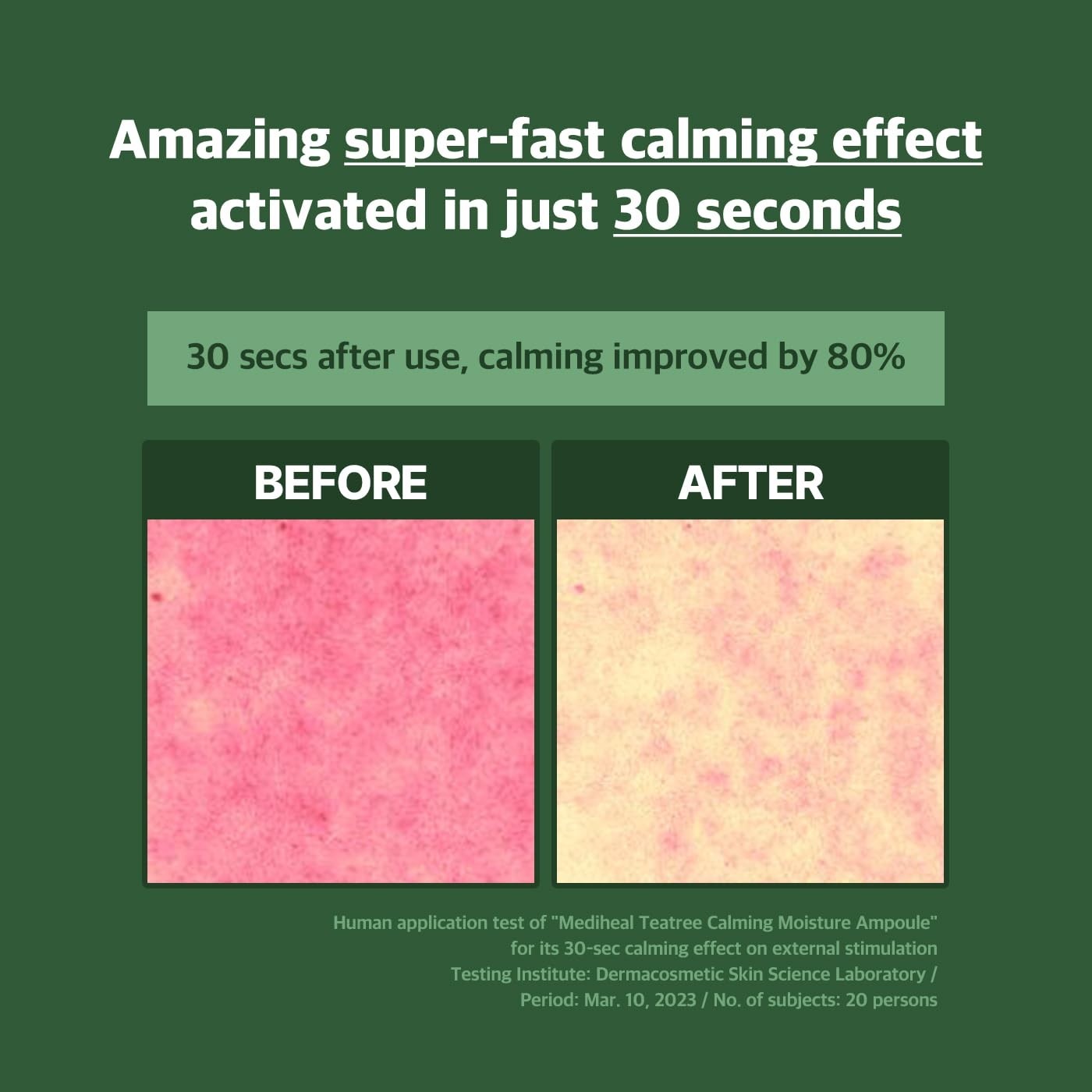 Calming Moisture Ampoule with 92% Tea Tree Leaf Water 1.7 fl oz – For All Skin