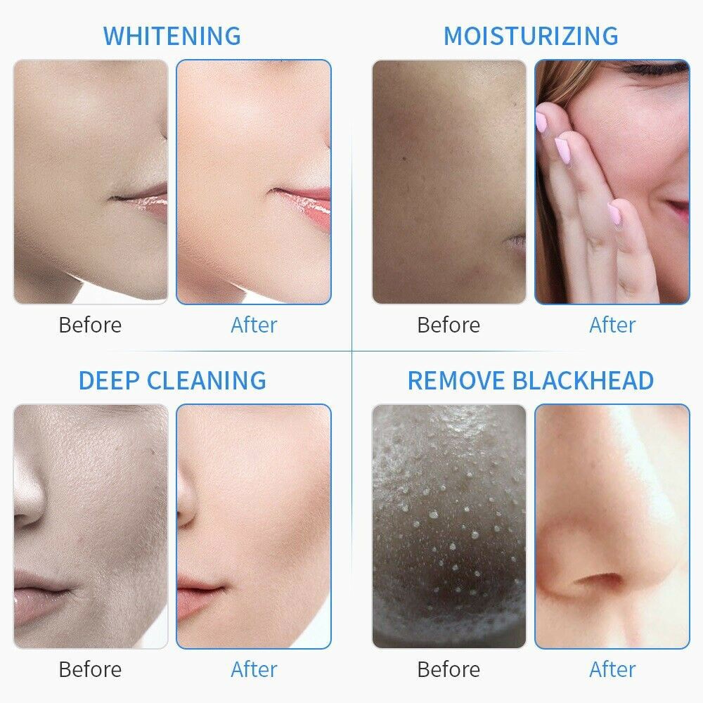 6/7 in 1 Hydrogen Water Facial Cleaner Aqua Peel Dermabrasion Beauty Machine