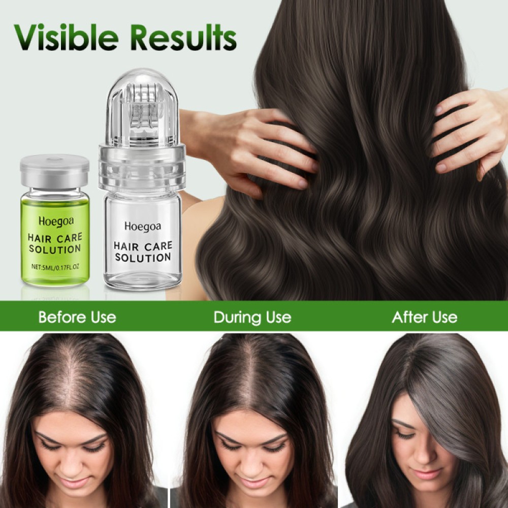 Micro Infuse Hair Regrowth System, Advanced Hair Growth Serum Treatment Ginseng