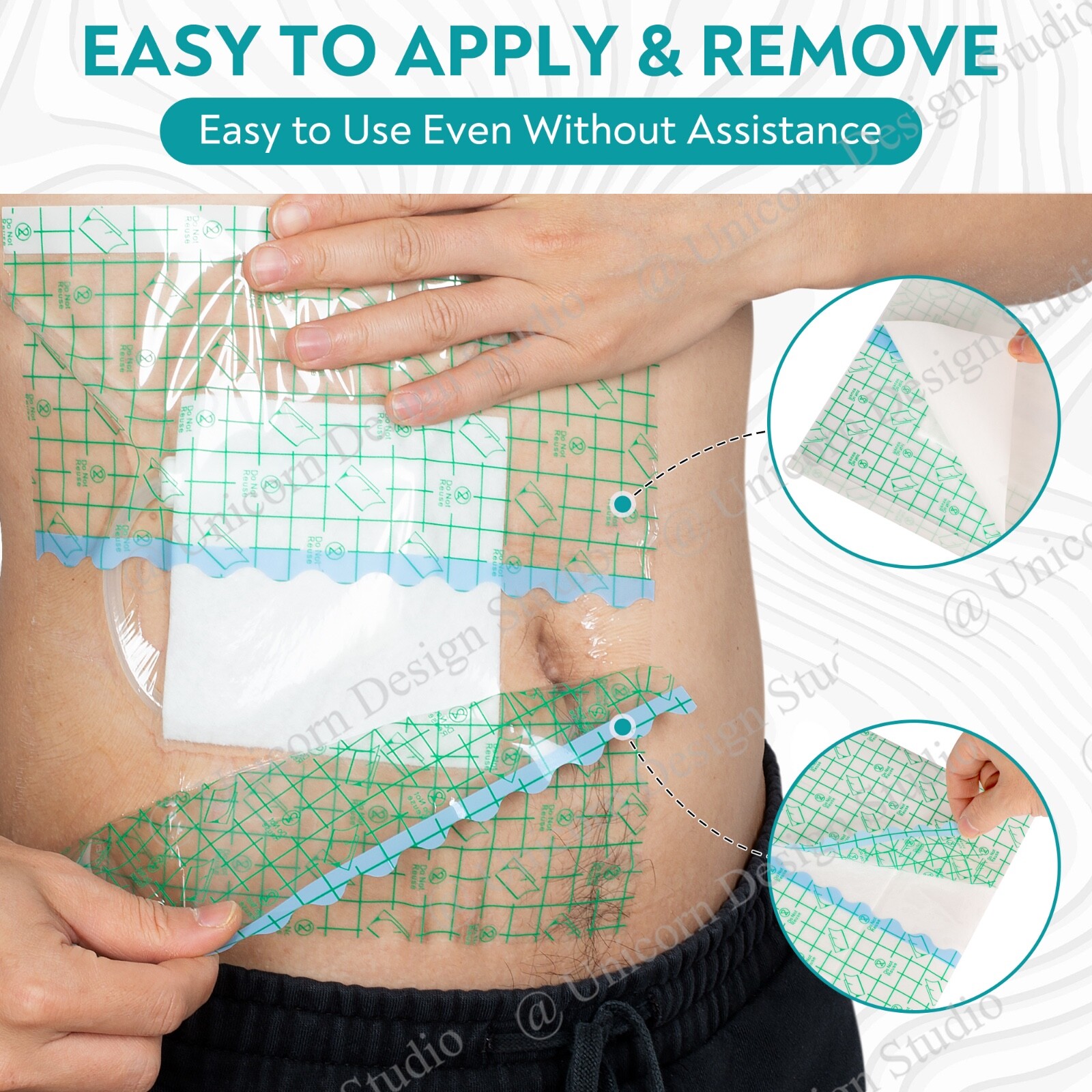 Large Waterproof Dressing for Wounds, Hemodialysis Peritoneal Dialysis Catheter