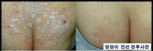 3 Lot of ISAL Atopy Eczema Cream Lotion./Made in USA