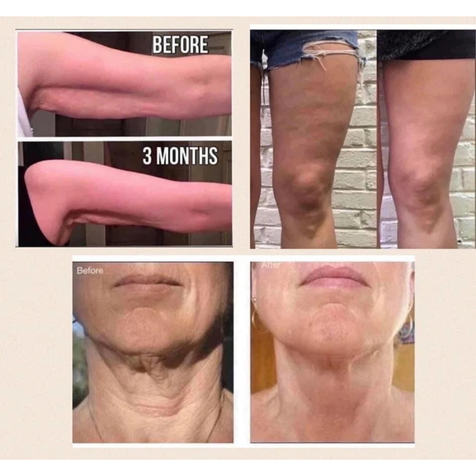 Nu Skin ageLOC® Dermatic Effects Sealed Fast Shipping