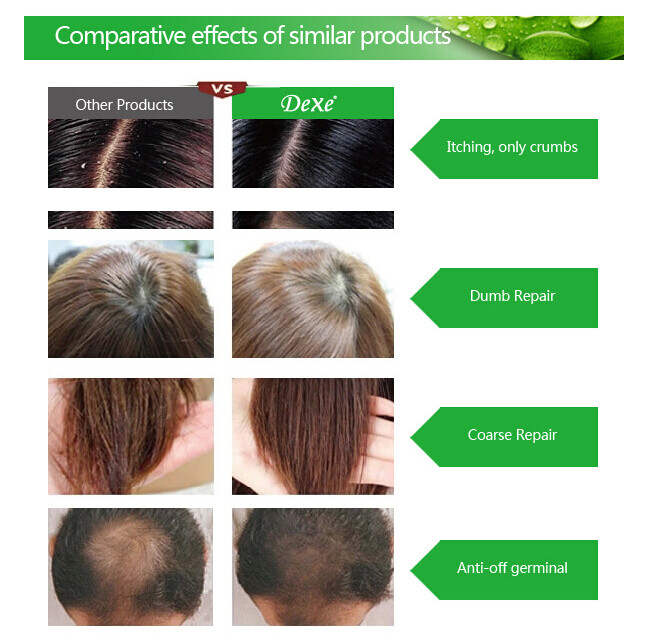 DEXE Anti-Hair Loss Shampoo Chinese Herbal Hair Regrowth For Men & Women 200ml