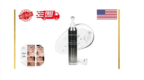 Share Dark Spot Remover for Face and Body Musely Dark Spot Remover for Melasma S
