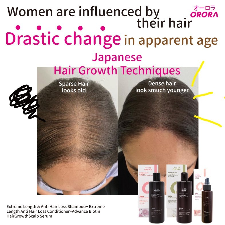 Orora Extreme Length & Anti Hair Loss Shampoo 300ML