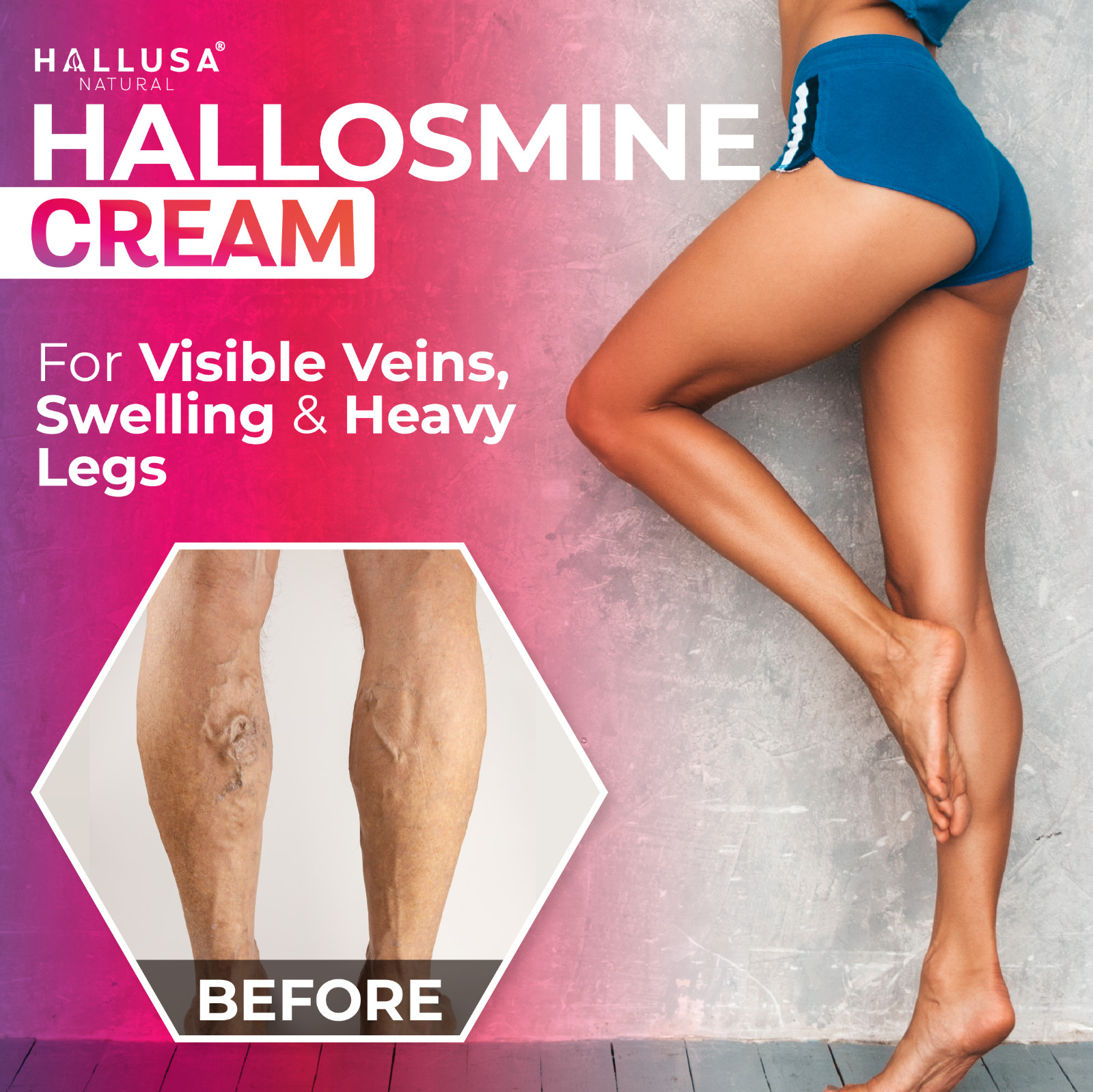 Varicose Veins Treatment for Legs | Varicose Veins Cream for Pain Relief | 4oz